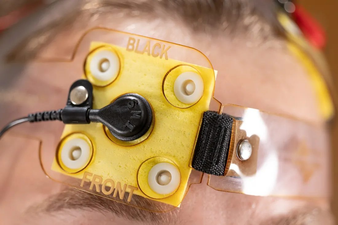 A transcranial direct current stimulation device around a patient's forehead.