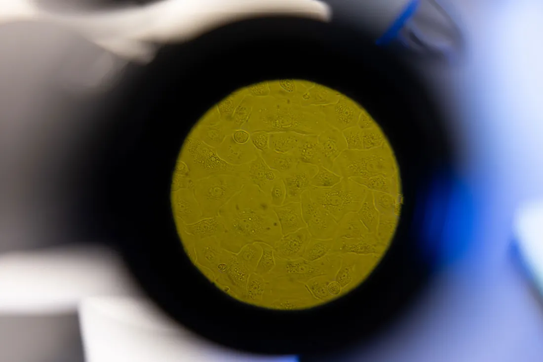 Image of a cell under a microscope.